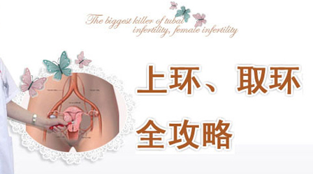 取环疼不疼？无痛取环，就选玛丽亚妇产儿童医